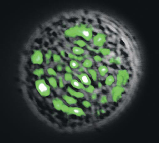 Клетки печени испускают зеленые лучи.